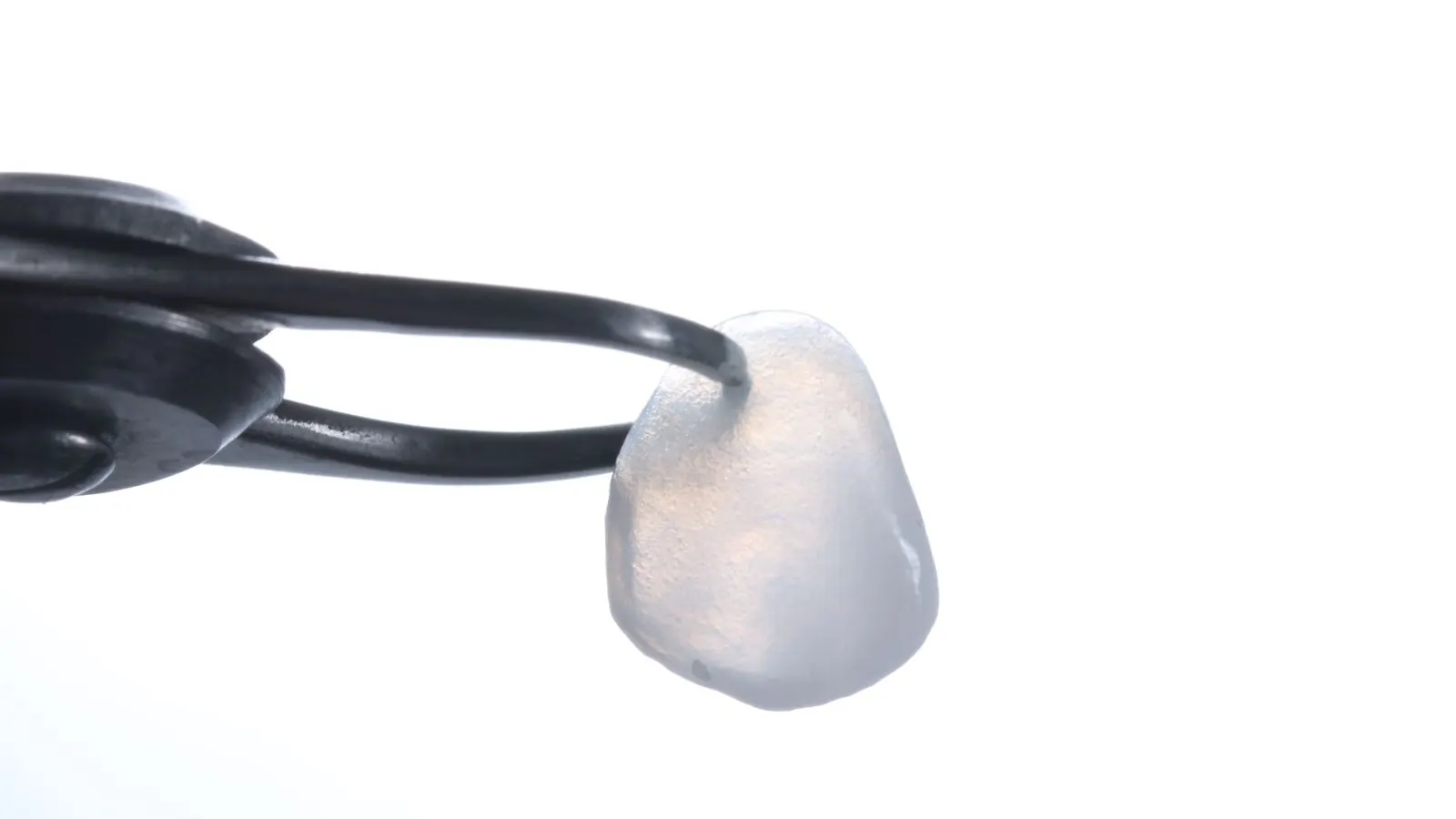 Lentes de contato dental em porcelana com textura e translucidez naturais