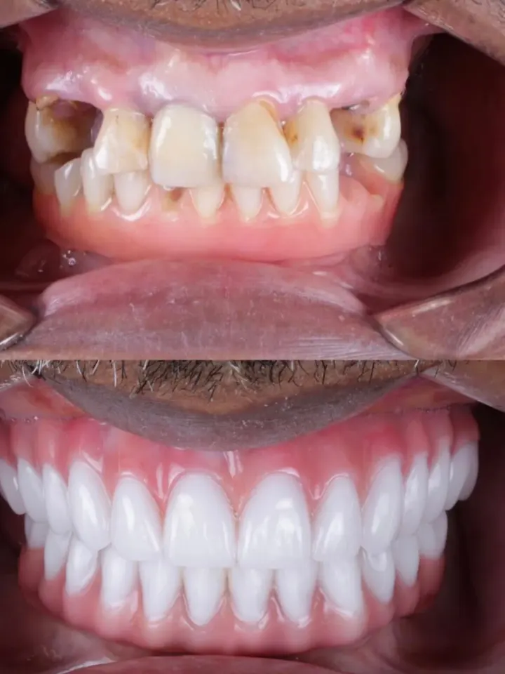 Antes e depois de tratamento estético realizado pelo Dr. Renato Alfo