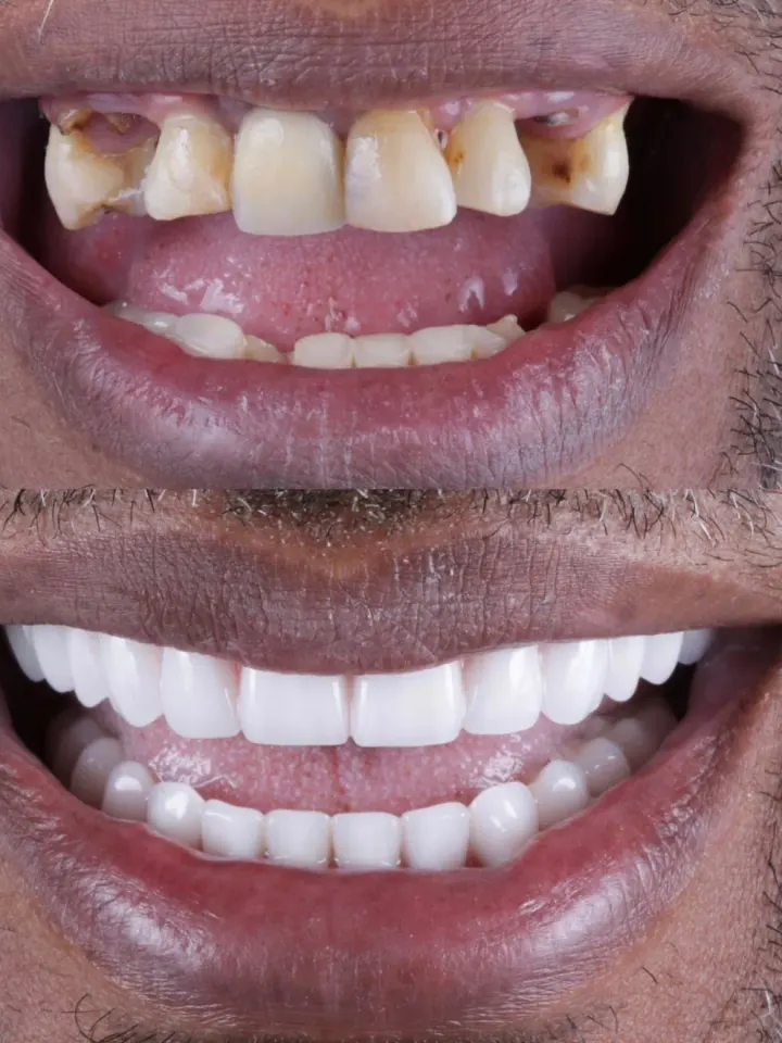 Antes e depois de tratamento estético realizado pelo Dr. Renato Alfo